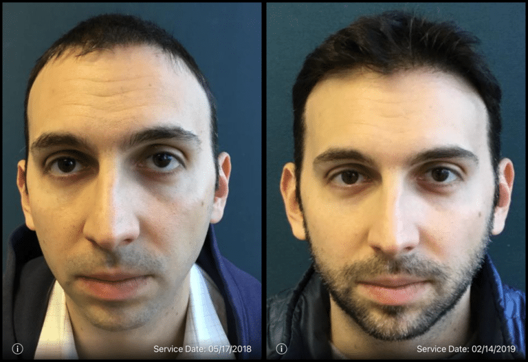 IMG_2043-e1734467650585-768x526